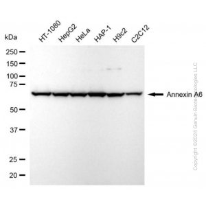KD-Validated ANXA6 Rabbit mAb (20 μl)