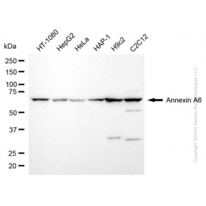 KD-Validated ANXA6 Rabbit mAb (20 μl)