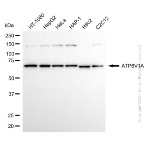 KD-Validated ATP6V1A Rabbit mAb (20 μl)