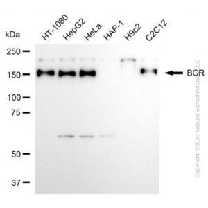 KD-Validated BCR Rabbit mAb (20 μl)
