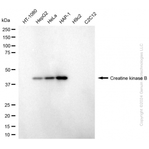 KD-Validated CKB Mouse mAb (20 μl)