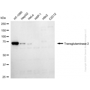 KD-Validated TGM2 Mouse mAb (20 μl)