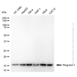 KD-Validated RBX1 Mouse mAb (20 μl)