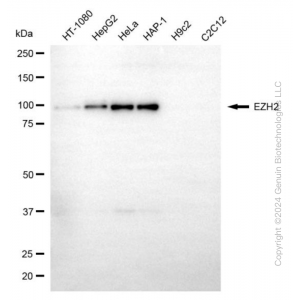 KD-Validated EZH2 Mouse mAb (20 μl)