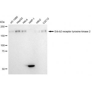 KD-Validated HER2 Rabbit mAb (20 μl)