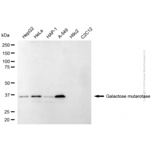KD-Validated GALM Mouse mAb (20 μl)