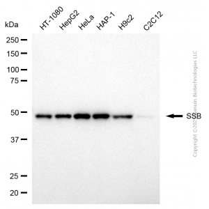KD-Validated SSB Mouse mAb (20 μl)