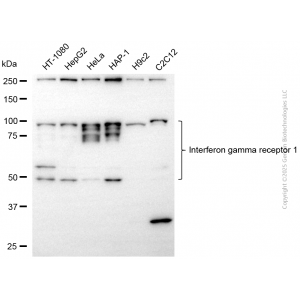 KD-Validated IFNGR1 Rabbit mAb (20 μl)