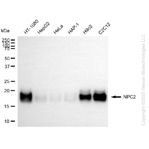 KD-Validated NPC2 Rabbit mAb (20 μl)