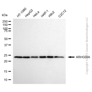 KD-Validated ARHGDIA Rabbit mAb (20 μl)