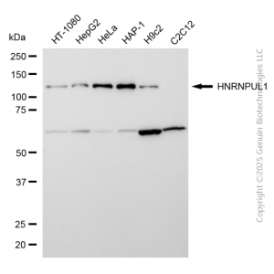 KD-Validated HNRNPUL1 Rabbit mAb (20 μl)