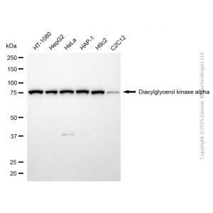 KD-Validated DGKA Rabbit mAb (20 μl)