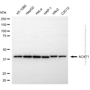 KD-Validated ACAT1 Rabbit pAb (20 μl)