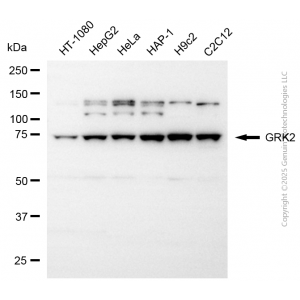 KD-Validated GRK2 Rabbit pAb (20 μl)