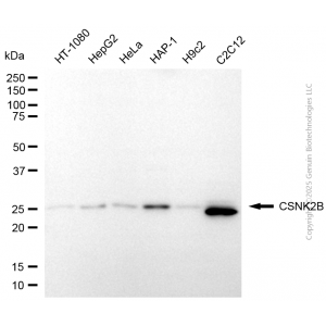 KD-Validated CSNK2B Rabbit pAb (20 μl)