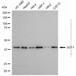KD-Validated GOT1 Rabbit pAb (20 μl)