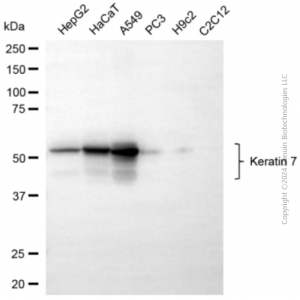 KD-Validated KRT7 Rabbit pAb (20 μl)