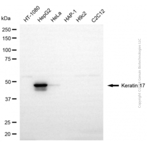 KD-Validated KRT17 Rabbit pAb (20 μl)