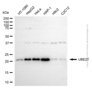 KD-Validated UBE2T Rabbit pAb (20 μl)