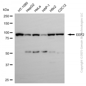 KD-Validated EEF2 Rabbit pAb (20 μl)