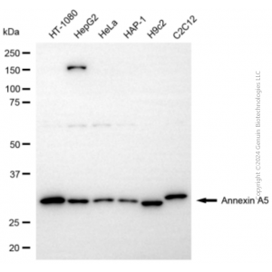 KD-Validated ANXA5 Rabbit pAb (20 μl)