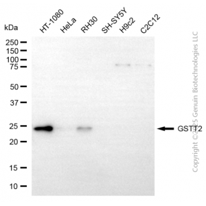 KD-Validated GSTT2 Mouse mAb (20 μl)