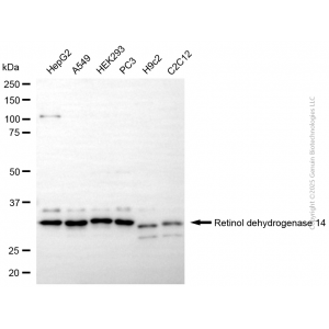 KD-Validated RDH14 Mouse mAb (20 μl)