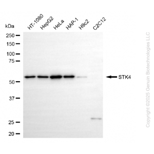 KD-Validated STK4 Rabbit mAb (20 μl)
