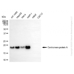 KD-Validated CENPA Rabbit mAb (20 μl)