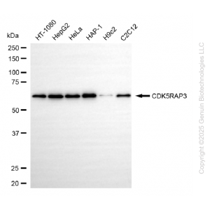 KD-Validated CDK5RAP3 Rabbit mAb (20 μl)