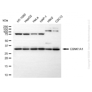 KD-Validated CSNK1A1 Rabbit mAb (20 μl)