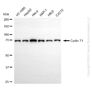 KD-Validated CCNT1 Rabbit mAb (20 μl)