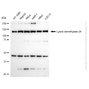 KD-Validated KDM2A Rabbit mAb (20 μl)