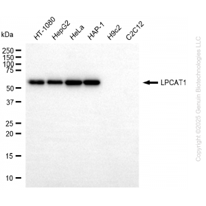 KD-Validated LPCAT1 Rabbit mAb (20 μl)
