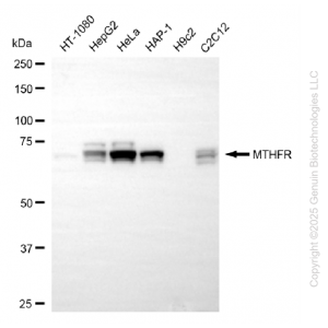 KD-Validated MTHFR Rabbit mAb (20 μl)
