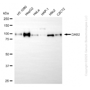 KD-Validated DAB2 Rabbit mAb (20 μl)