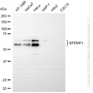 KD-Validated EFEMP1 Rabbit mAb (20 μl)