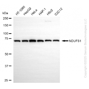 KD-Validated NDUFS1 Rabbit mAb (20 μl)