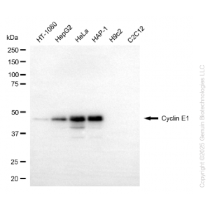 KD-Validated CCNE1 Rabbit mAb (20 μl)