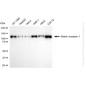 KD-Validated NOTCH1 Rabbit mAb (20 μl)