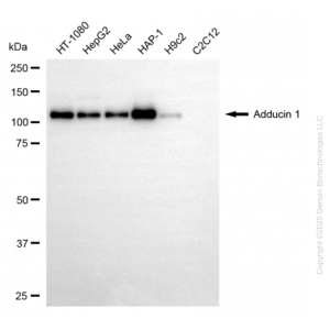 KD-Validated ADD1 Mouse Oligoclonal Antibody (20 μl)