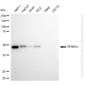 KD-Validated TFAP2C Rabbit mAb (20 μl)