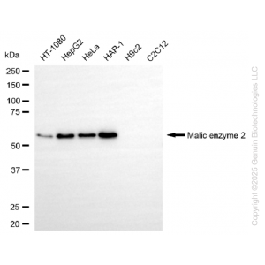 KD-Validated ME2 Rabbit mAb (20 μl)