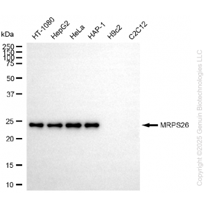 KD-Validated MRPS26 Rabbit mAb (20 μl)