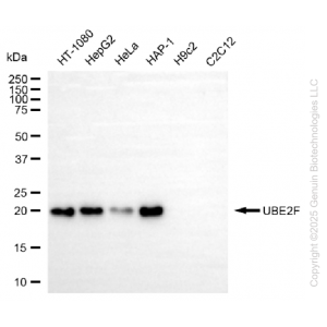 KD-Validated UBE2F Rabbit mAb (20 μl)