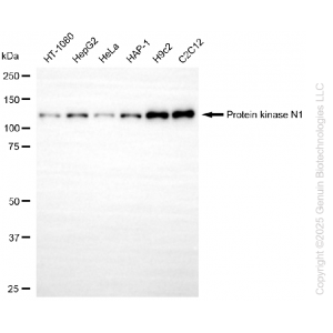 KD-Validated PKN1 Rabbit mAb (20 μl)