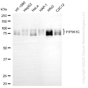 KD-Validated PIP5K1C Rabbit mAb (20 μl)