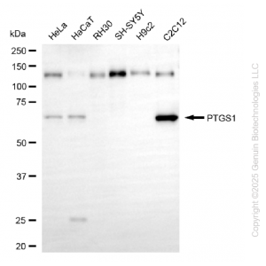 KD-Validated PTGS1 Rabbit mAb (20 μl)