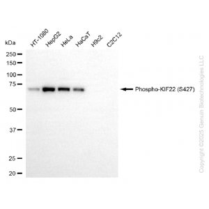 KD-Validated Phospho-KIF22 (S427) Rabbit mAb (20 μl)