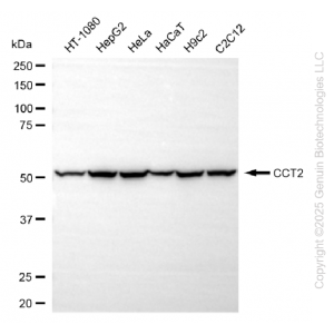 KD-Validated CCT2 beta Rabbit mAb (20 μl)